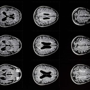 Brain scans. Diagnosis: Brain dead. The title of "Dead Epidemiologists" refers not to the loss of eminent scientists to Coronavirus, but the failure of establishment epidemiologists to address the root causes before it began. Did it cross their minds to think ahead?